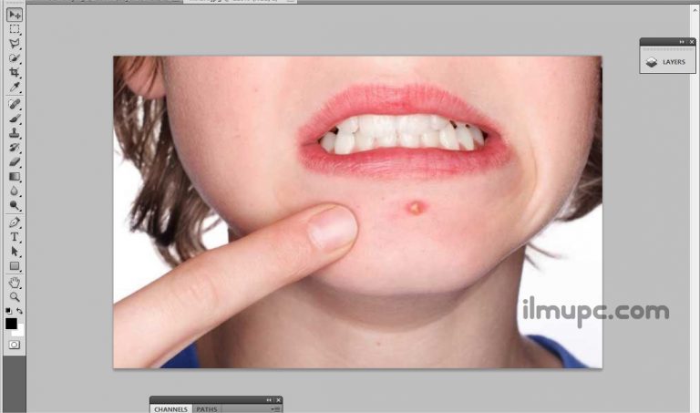 Cara Menghilangkan Jerawat di Photoshop
