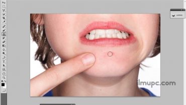 cara menghapus jerawat di Photoshop