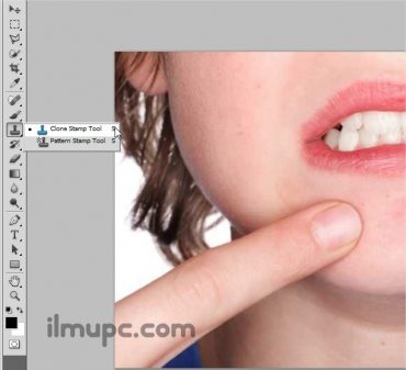 menghapus jerawat di Photoshop